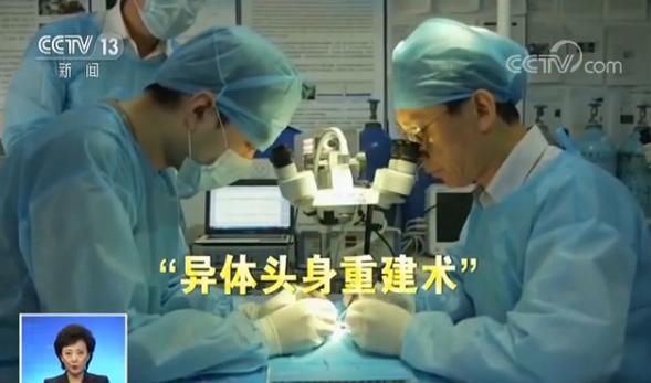 全球第一例人类换头术成功！中国教授领导