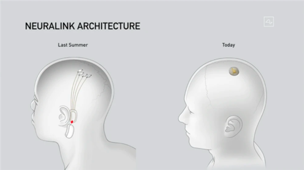 马斯克展示脑机接口新进展：芯片植入活猪 实时读取猪脑信息